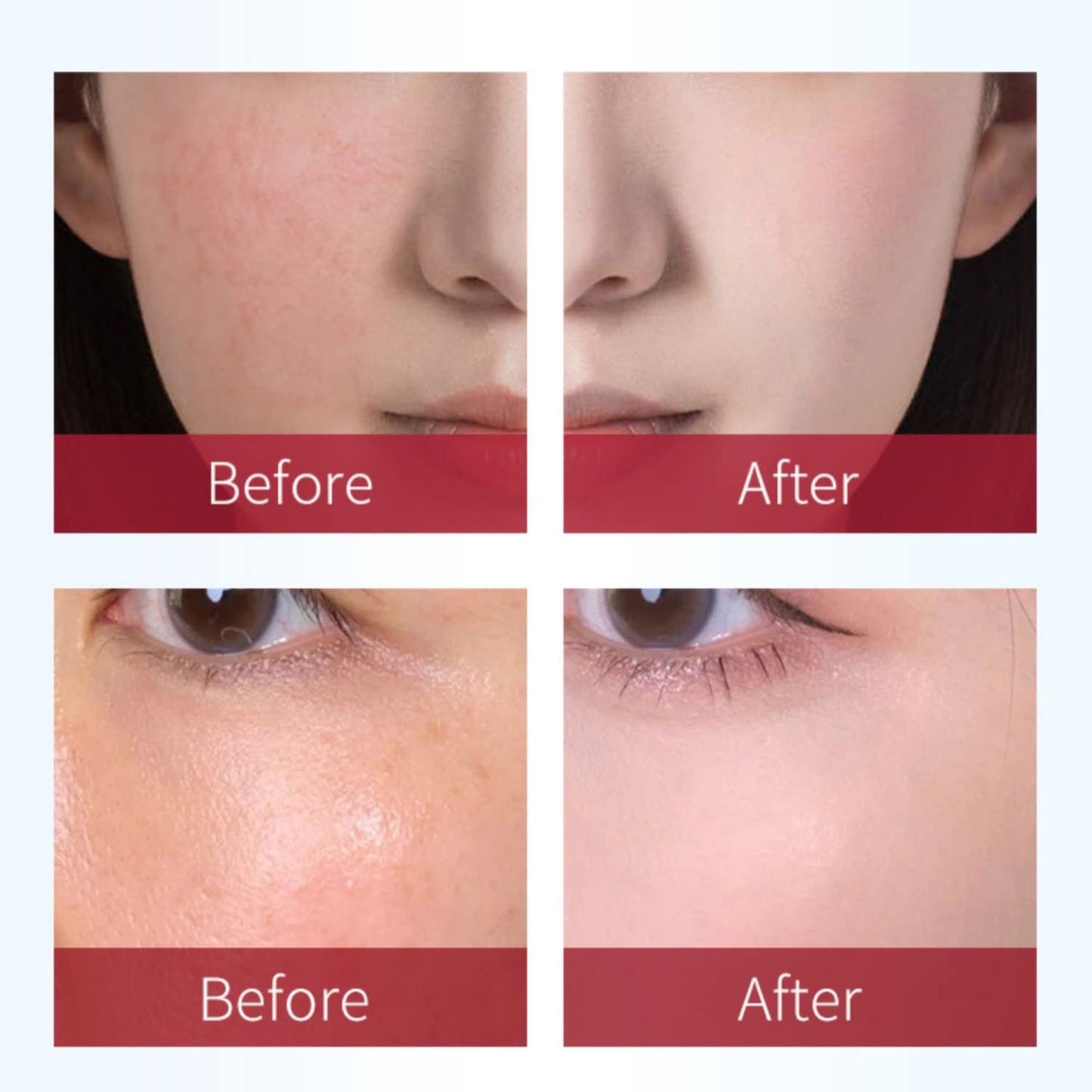 Beauty-Mall Rosaderm Fast Gel Cream | Gentle Redness Corrective Primer & Skin Tint