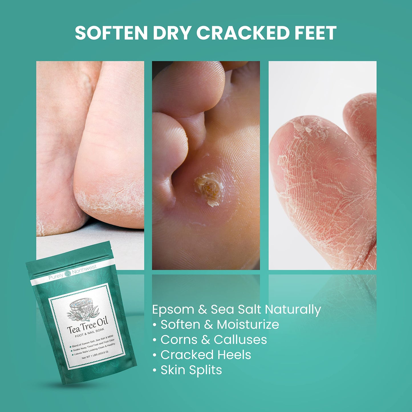 Purely Northwest 3 Lbs Tea Tree & Peppermint Foot Soak – MSM & Epsom Salt