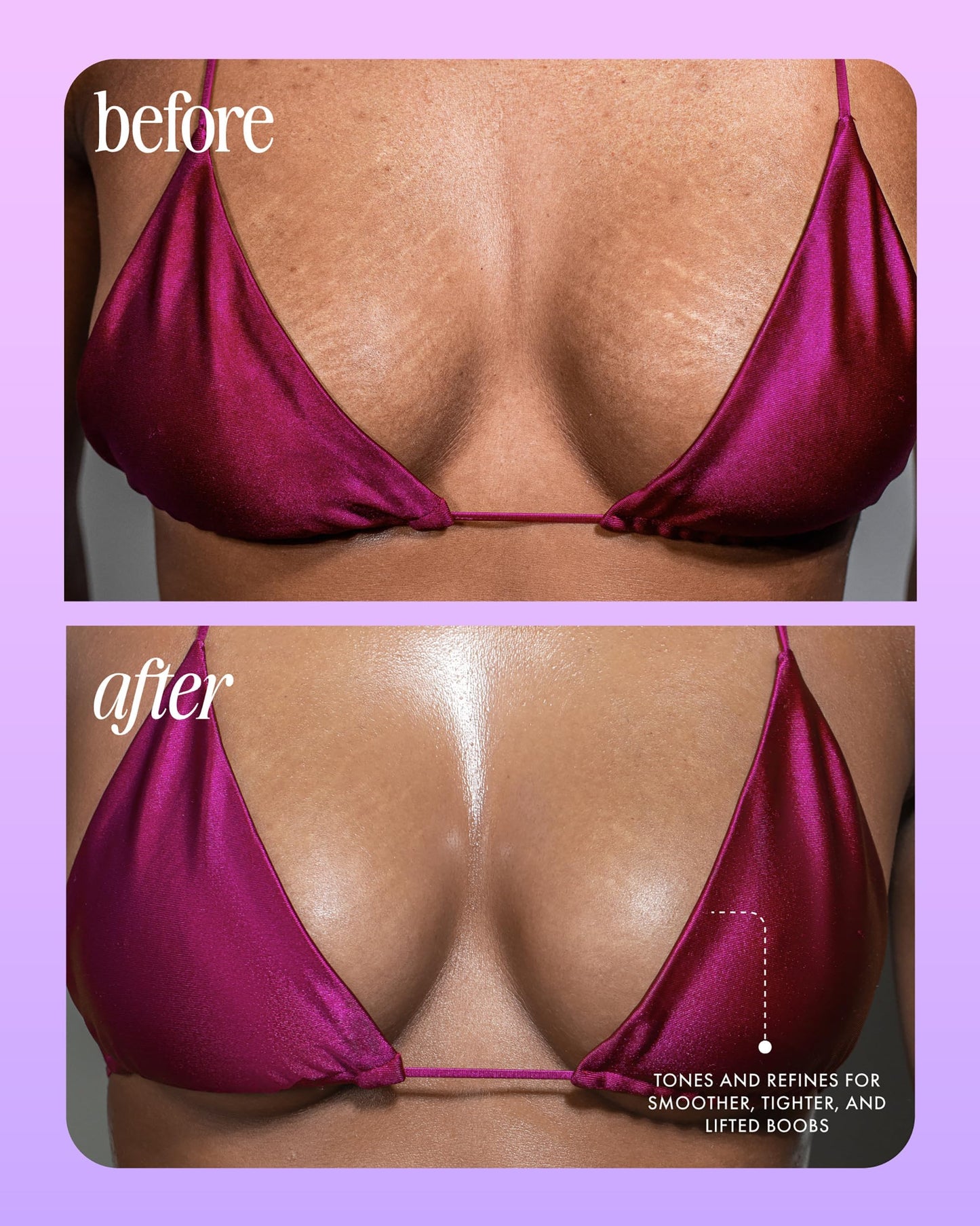 Truly Beauty Acai Your Boobies Serum – Bust Firming, Skin Elasticity, 3.1 oz