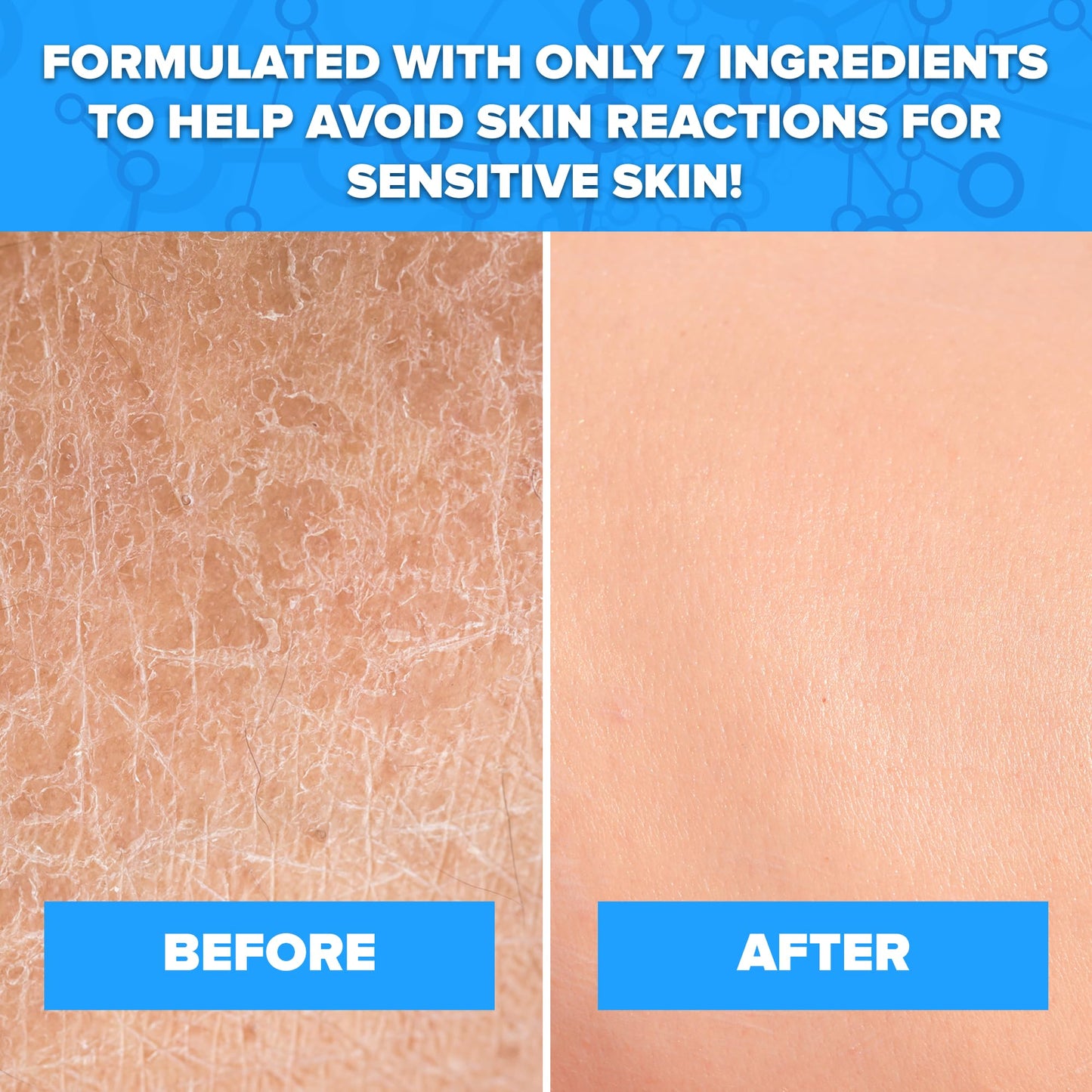 Aquanil Lipid-Free Cleanser for Sensitive Skin | Fragrance-Free, Soap-Free, 3 Pack – 16 oz