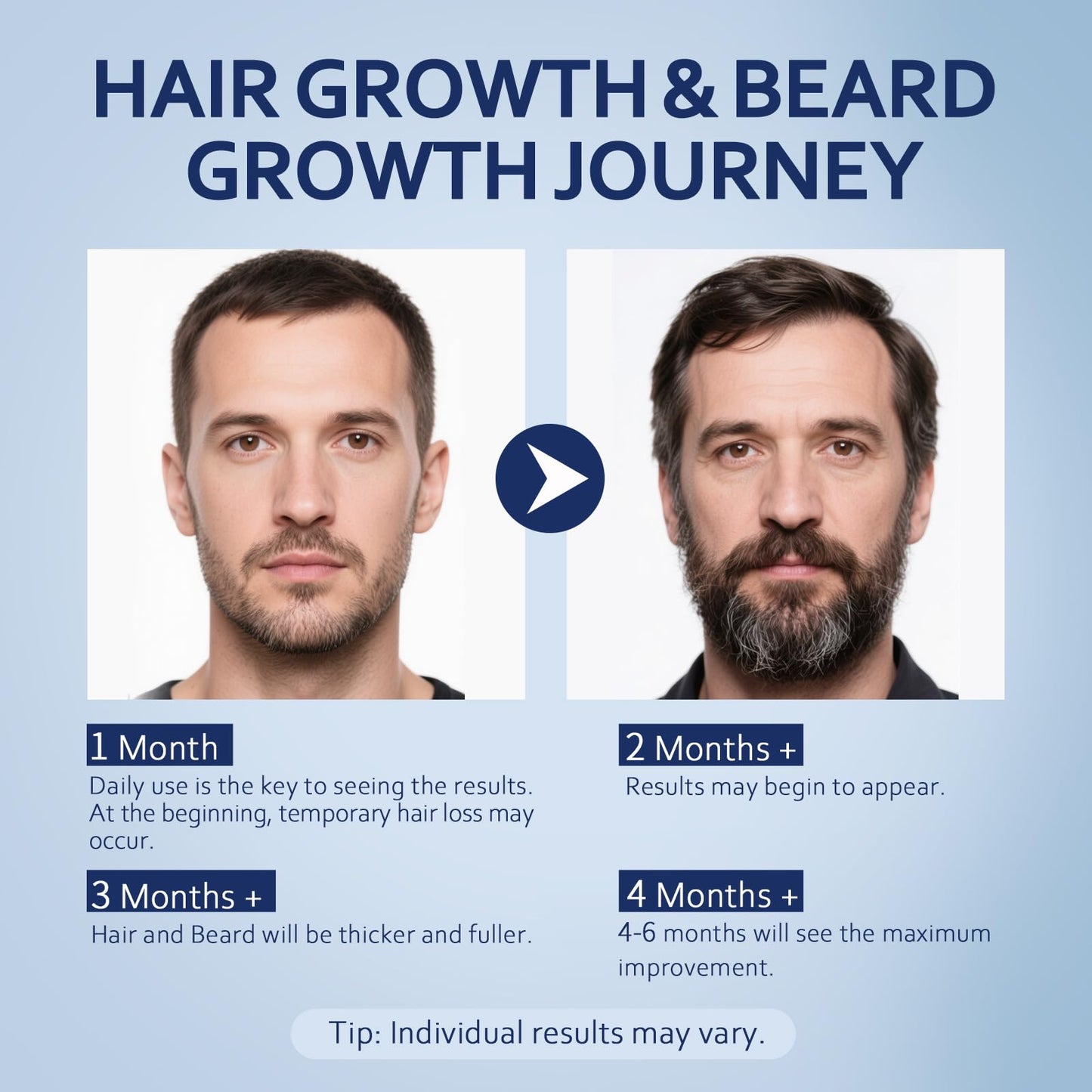 Artimore 5% Minoxidil Hair Growth Serum | Extra Strength, Unscented, 8 oz (4 bottles)