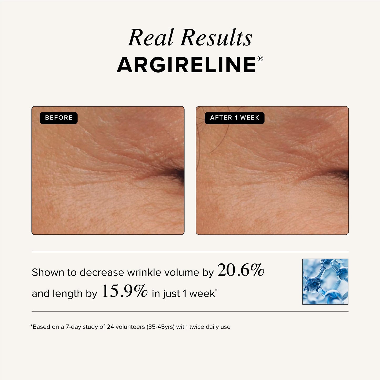 Asterwood Triple Repair Serum | Matrixyl 3000 + Argireline + Vitamin C + Hyaluronic Acid (Fragrance-Free) – 4 Fl Oz