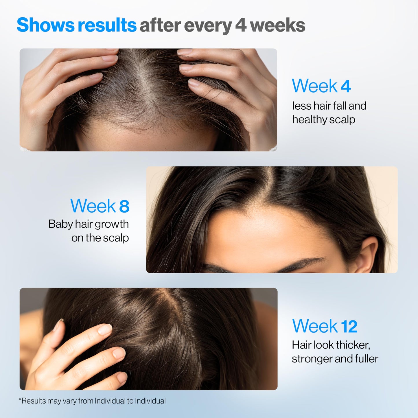 Be Bodywise Rosemary Hair Growth Serum Roll-On 25 ml | 3% Rosemary, 3% Redensyl & 2% Anagain | Paraben/Sulfate-Free
