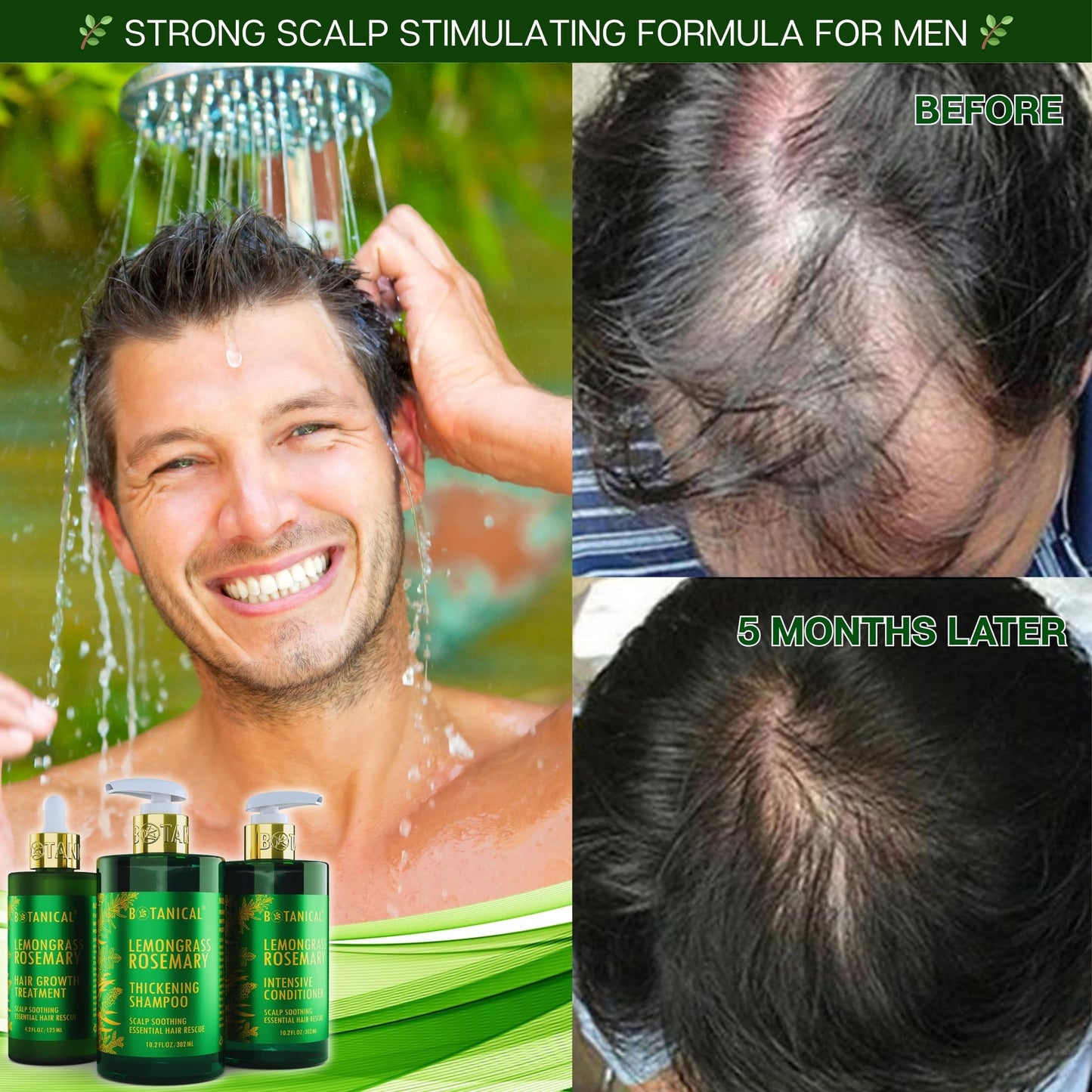 Botanical Hair Growth Lab Rosemary Shampoo with Saw Palmetto – Thinning Hair Support (10.2 oz)