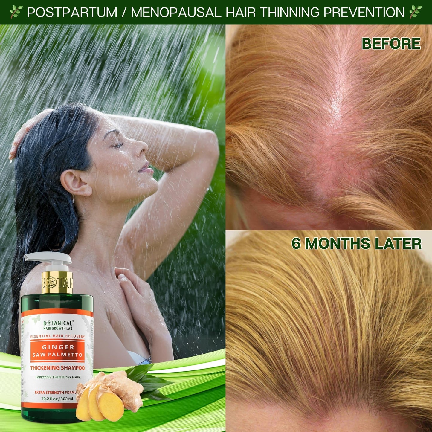 Botanical Hair Growth Shampoo with Ginger & Saw Palmetto – Thickening & Scalp Stimulation (10.2 fl oz) | BOTANICAL HAIR GROWTH LAB