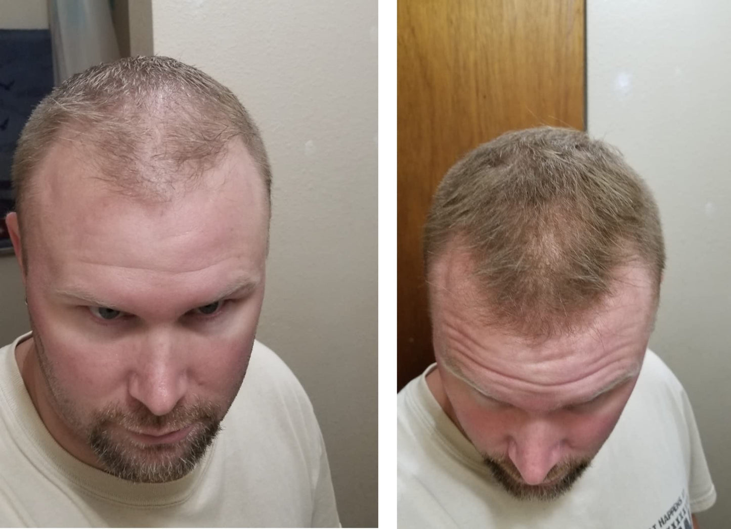 Caboki Hair Loss Concealer – Instantly Look 10x Fuller, Cover Bald Spots (30G, 90-Day Supply) Light Brown