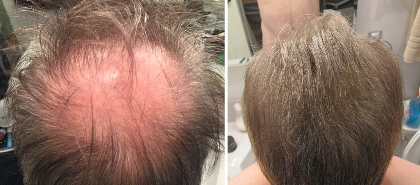 Caboki Hair Loss Concealer – Instantly Look 10x Fuller, Cover Bald Spots (30G, 90-Day Supply) Light Brown