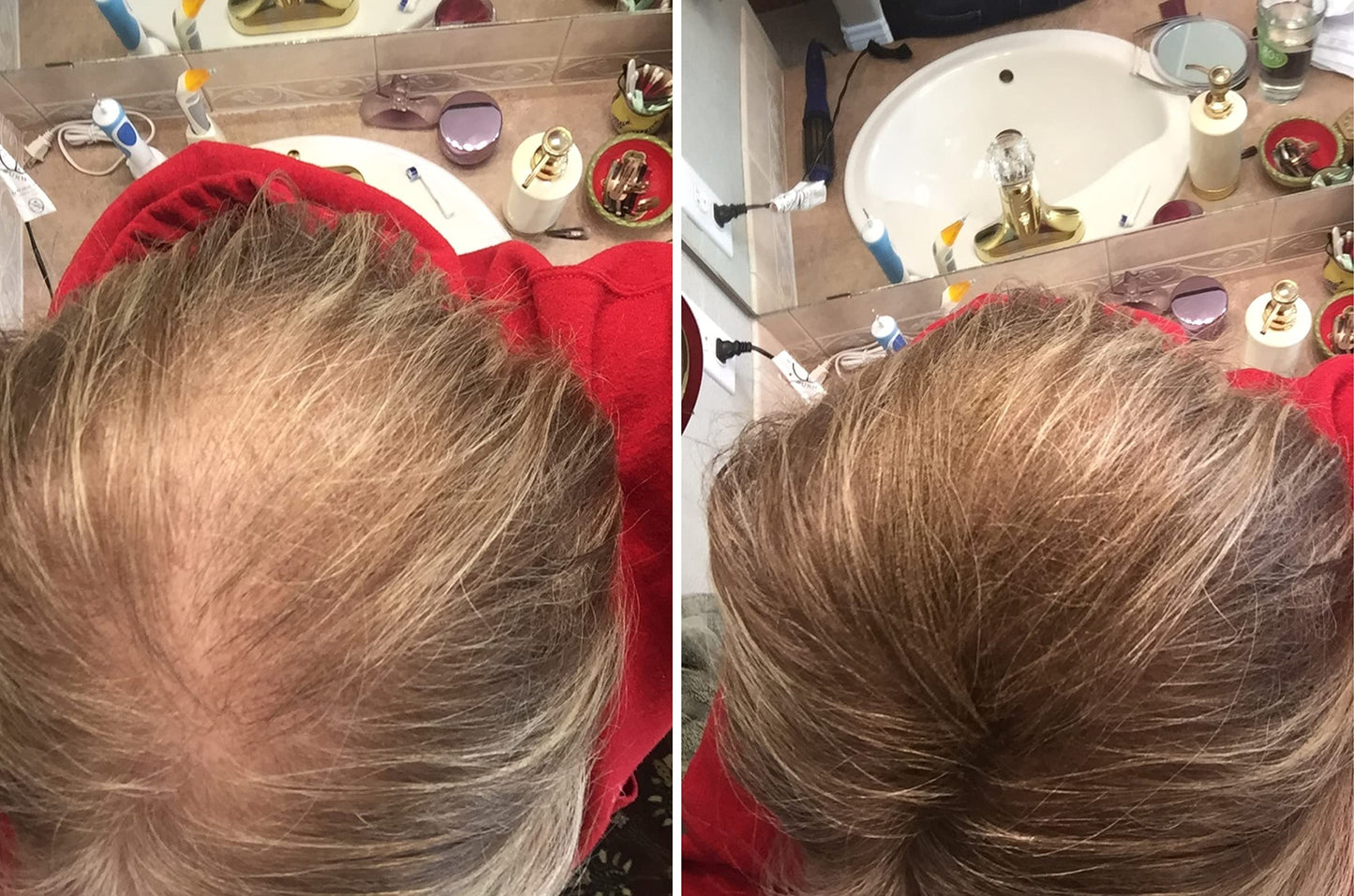 Caboki Hair Loss Concealer – Instantly Look 10x Fuller, Cover Bald Spots (30G, 90-Day Supply) Light Brown
