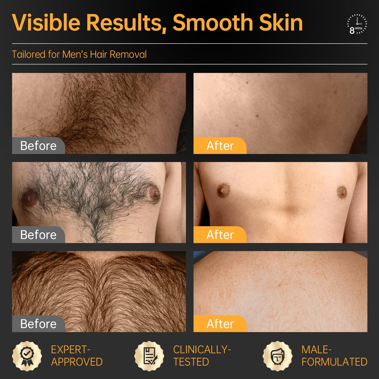 CKM Hair Removal Cream for Men — Painless Depilatory Gel, 6.76 FL OZ Pack of 2 (All Skin Types)