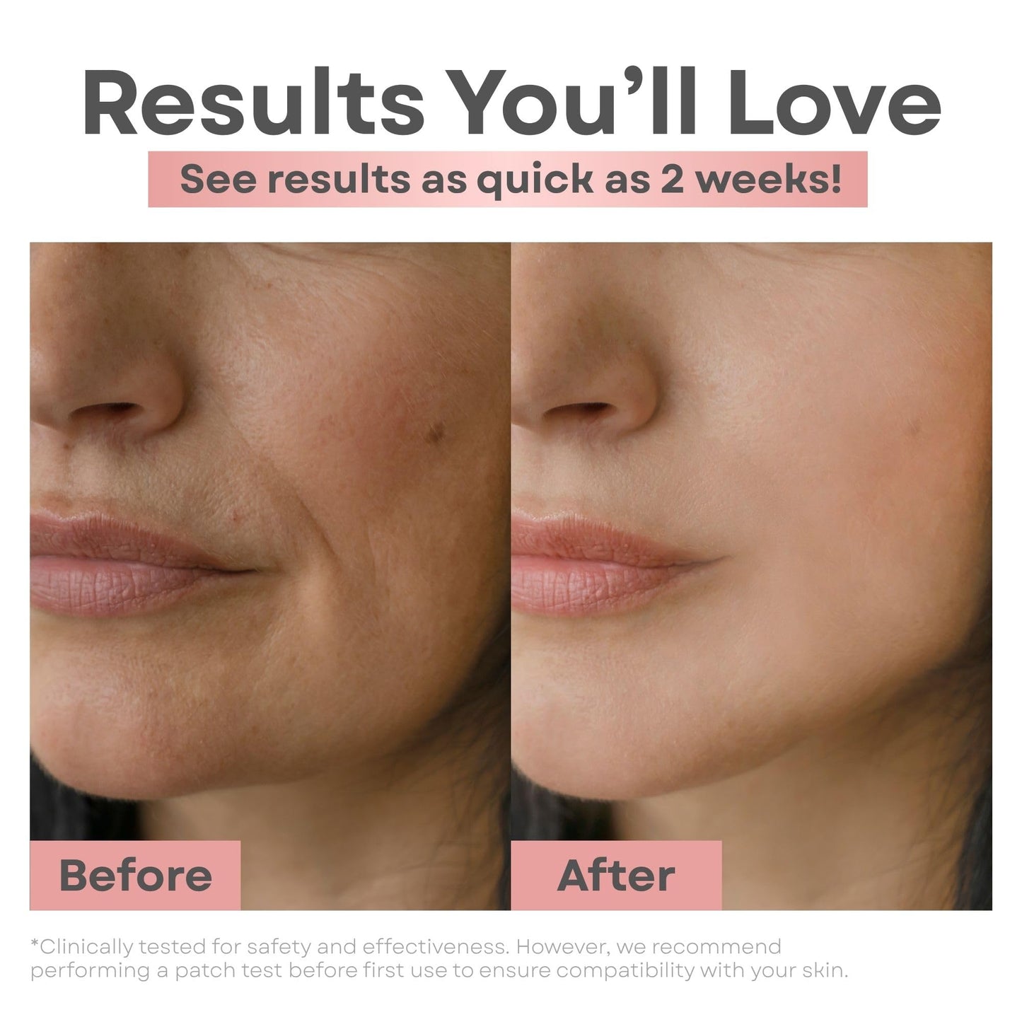 Clear Essence Skin Lightening Serum 1.7oz | Vitamin C Brightening, Dark Spot & Hyperpigmentation Corrector