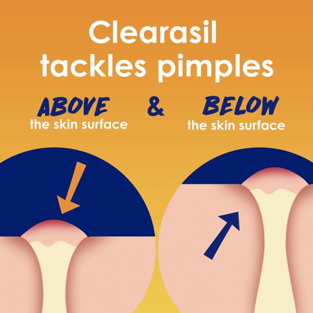 Clearasil 5-in-1 Acne Treatment Pads — Stubborn Acne Control, 90 Pads (3-Pack)