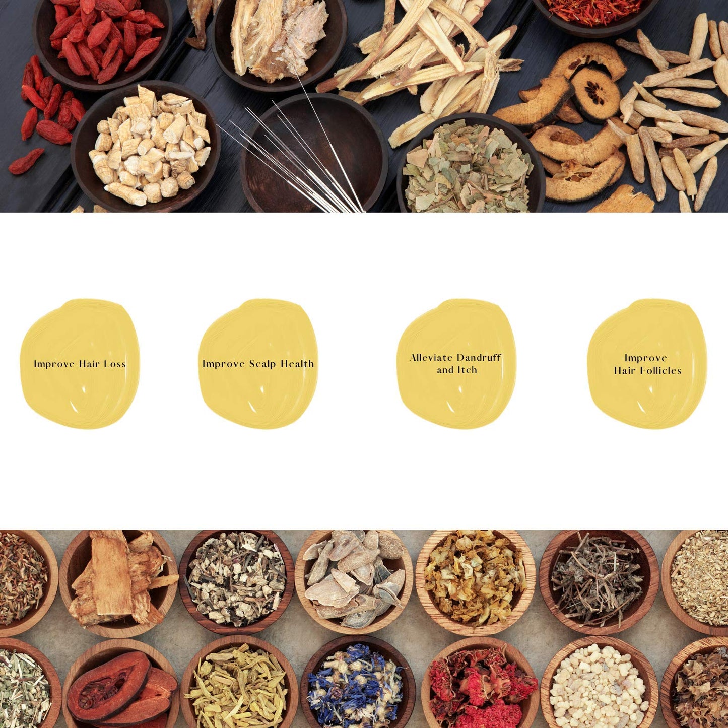 Daeng Gi Meo Ri Ki Gold Premium Treatment | Herbal Scalp & Hair Care with Korean Ginseng