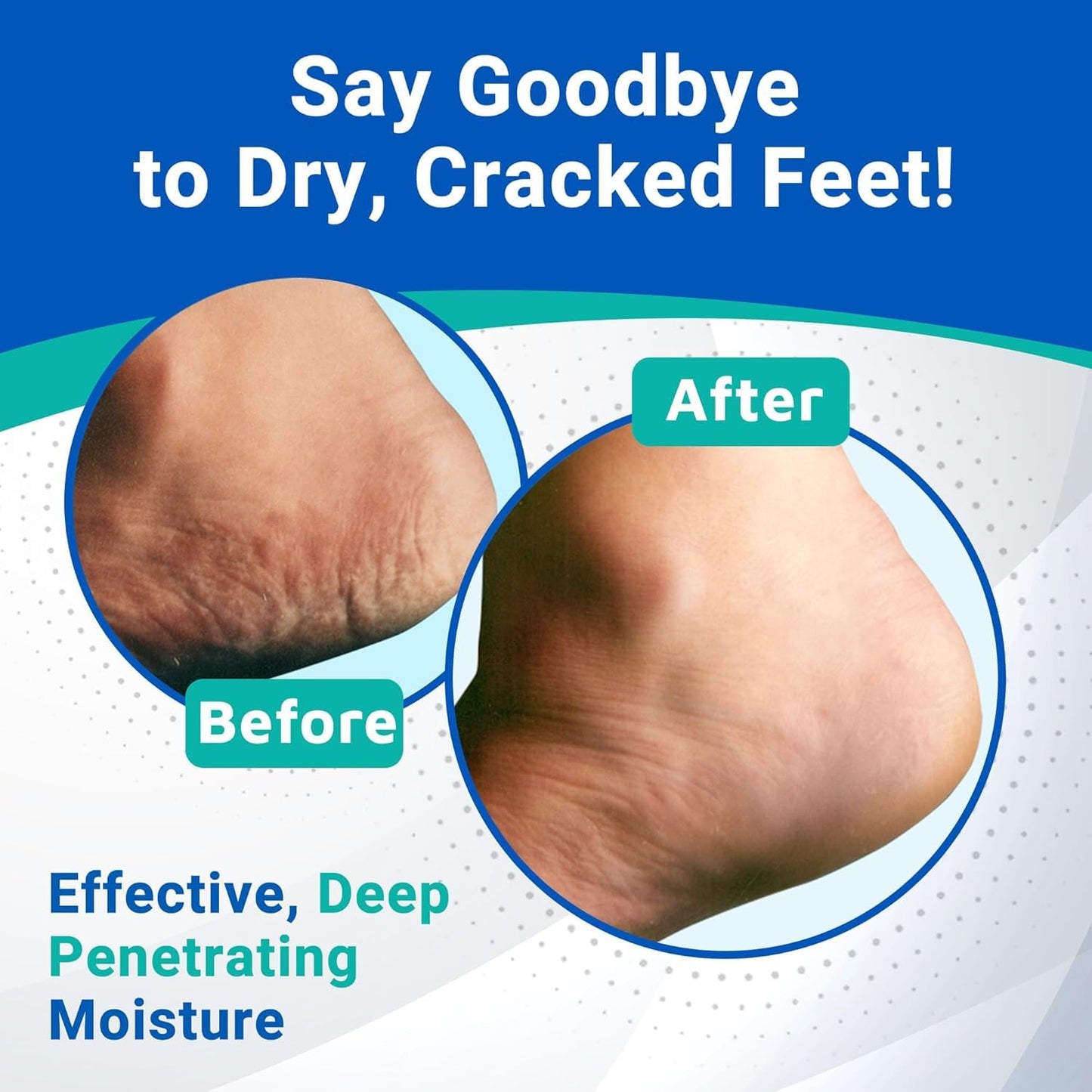Dermal Therapy Heel Care Cream – 25% Urea + 6% AHAs | Deep Moisturizing Foot Repair (3oz & 8oz Bundle)