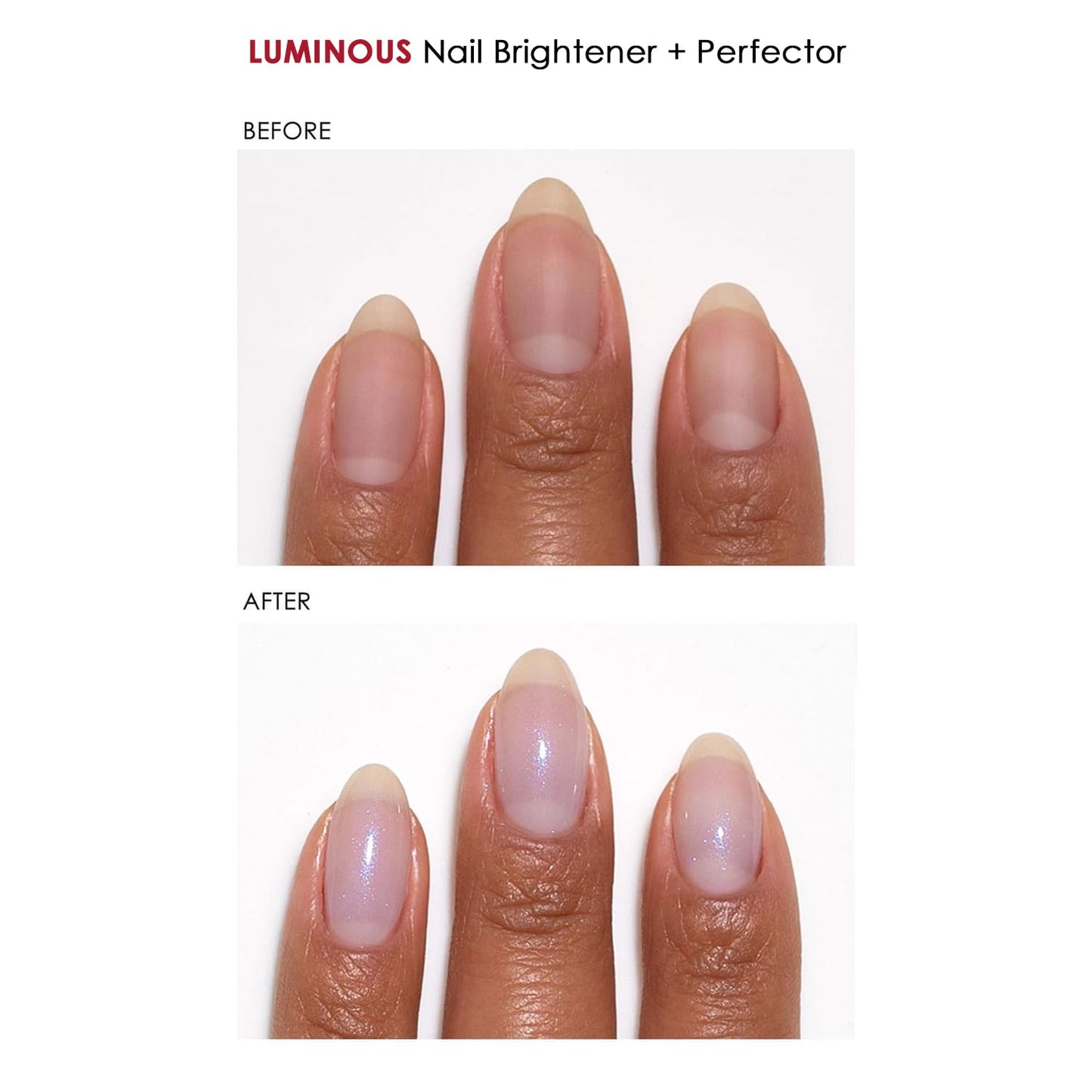 Dermelect Clean & Care Nail Renewal Kit – 3‑Step Nail Care for Strength, Brightness & Repair