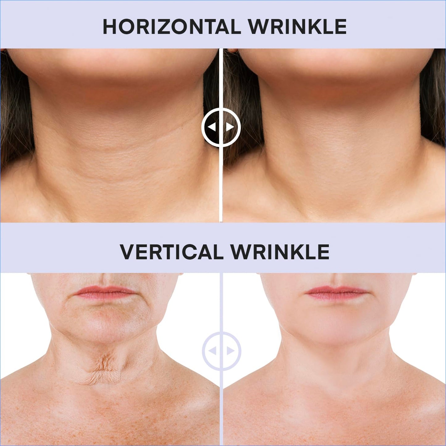 DERPHEA Neck Cream for Tightening & Firming – Advanced Neck Lift, 3.4 oz