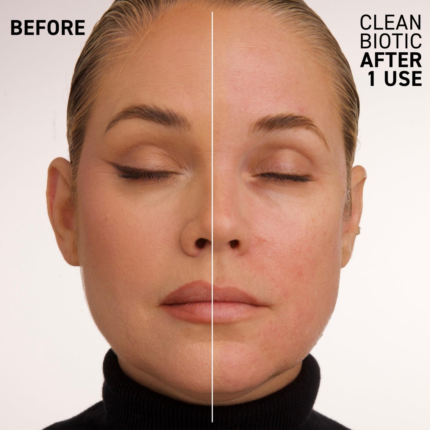 Dr. Brandt Skincare Clean Biotic Yogurt Cleanser – pH-Balanced, 3.5 oz