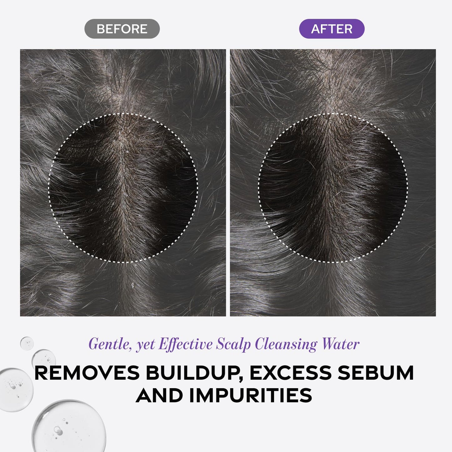 Dr. Groot Scalp Revitalizing Solution – Detox Water for Scalp Wellness