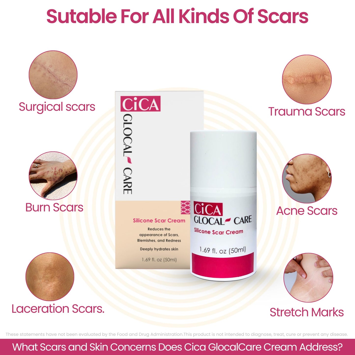 GlocalCare CICA Scar Cream – Silicone Scar Treatment for New & Old Scars, PIH & Stretch Marks (50 ml)