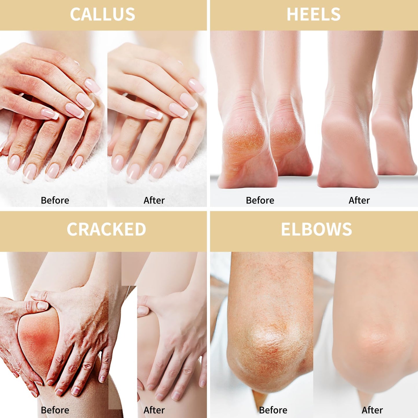 Grocerism Urea Cream 50% for Feet – 5.29 oz Two-Pack with Oat & 2% Salicylic Acid