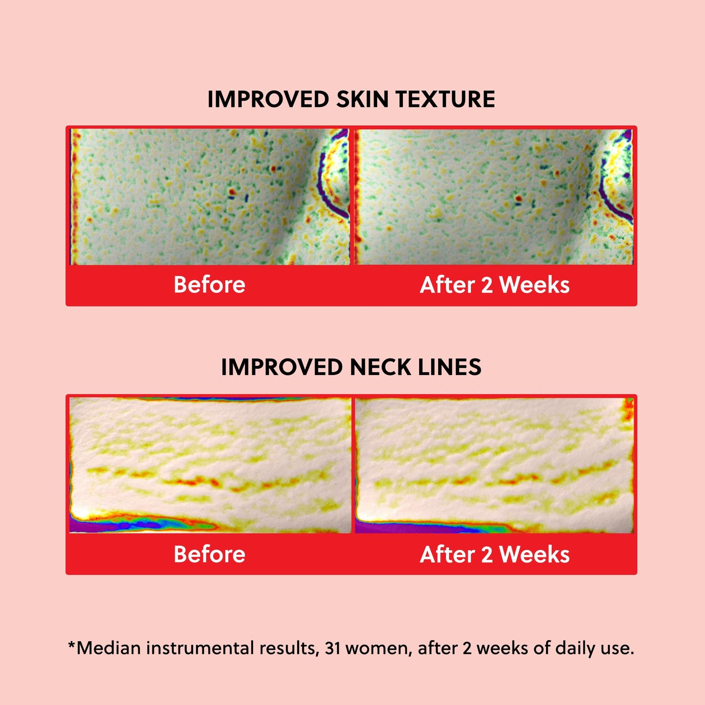 HANYUL Red Rice Hydrating Cream with Fermented Rice Extract | Vegan Ceramide Moisturizer for Deep Hydration & Radiant Skin