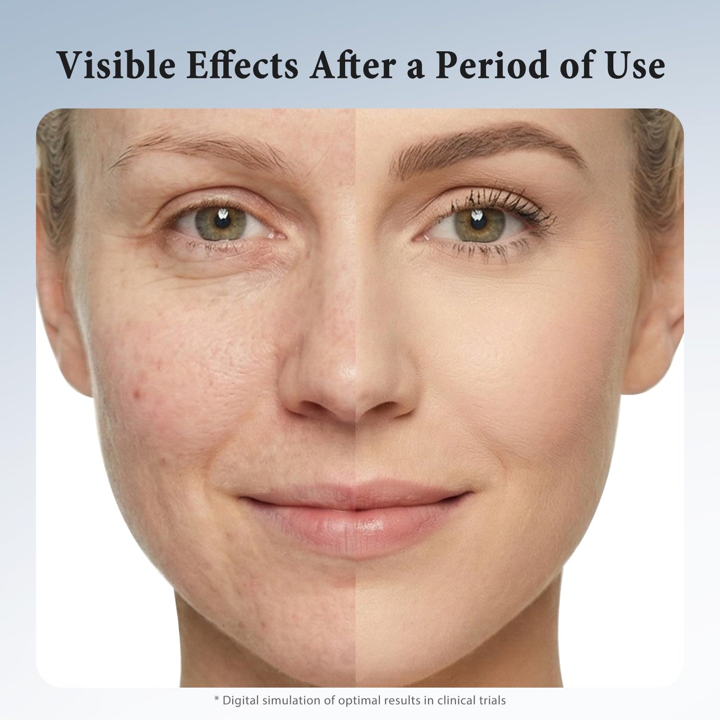 Hyuxeo Retinol Serum for Face – Deep Hydration & Anti-Aging (All Skin Types, 1.7 fl oz)