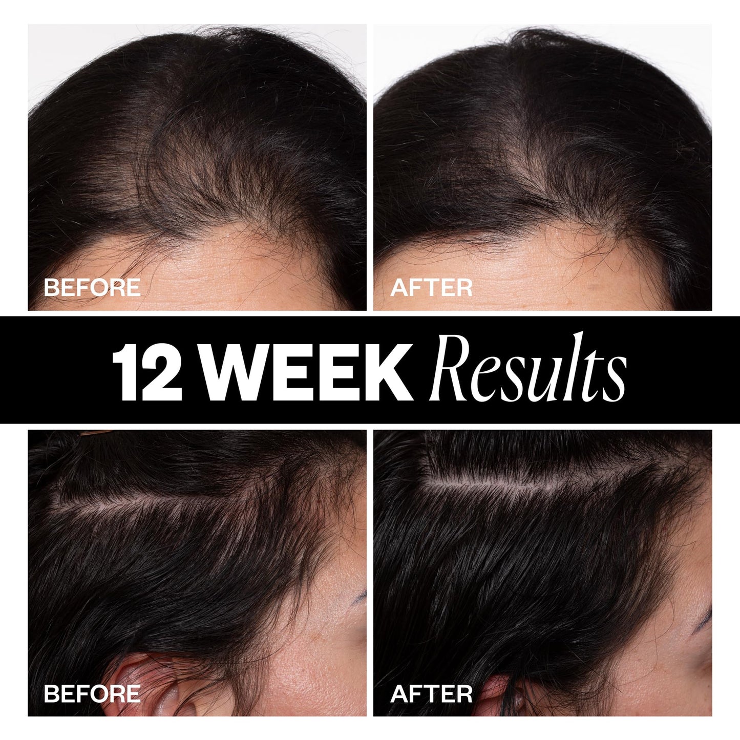 IGK Sponsored Scalp Treatment for Hair Growth – Serum-in-Mist for Fuller, Thicker Hair (2.1oz)