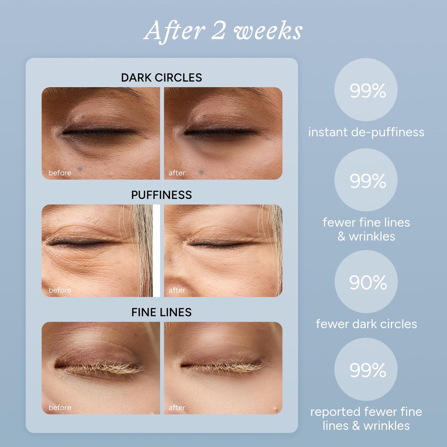 In My Eyes Caffeine & Hyaluronic Under Eye Patches PRO – 5 Pairs | 360° Coverage