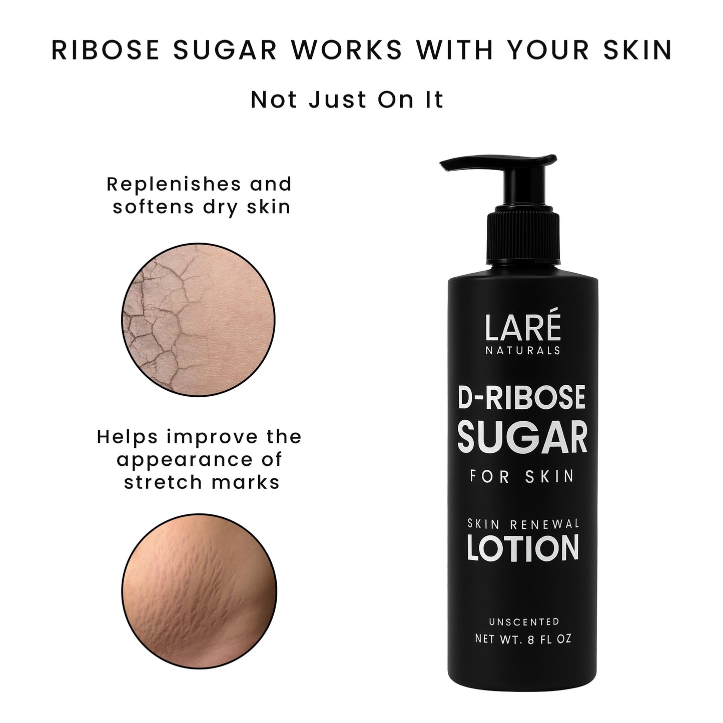 Laré Naturals Ribose Sugar Cream – Lightweight D-Ribose Moisturizer with Vitamin E, 8 oz Unscented