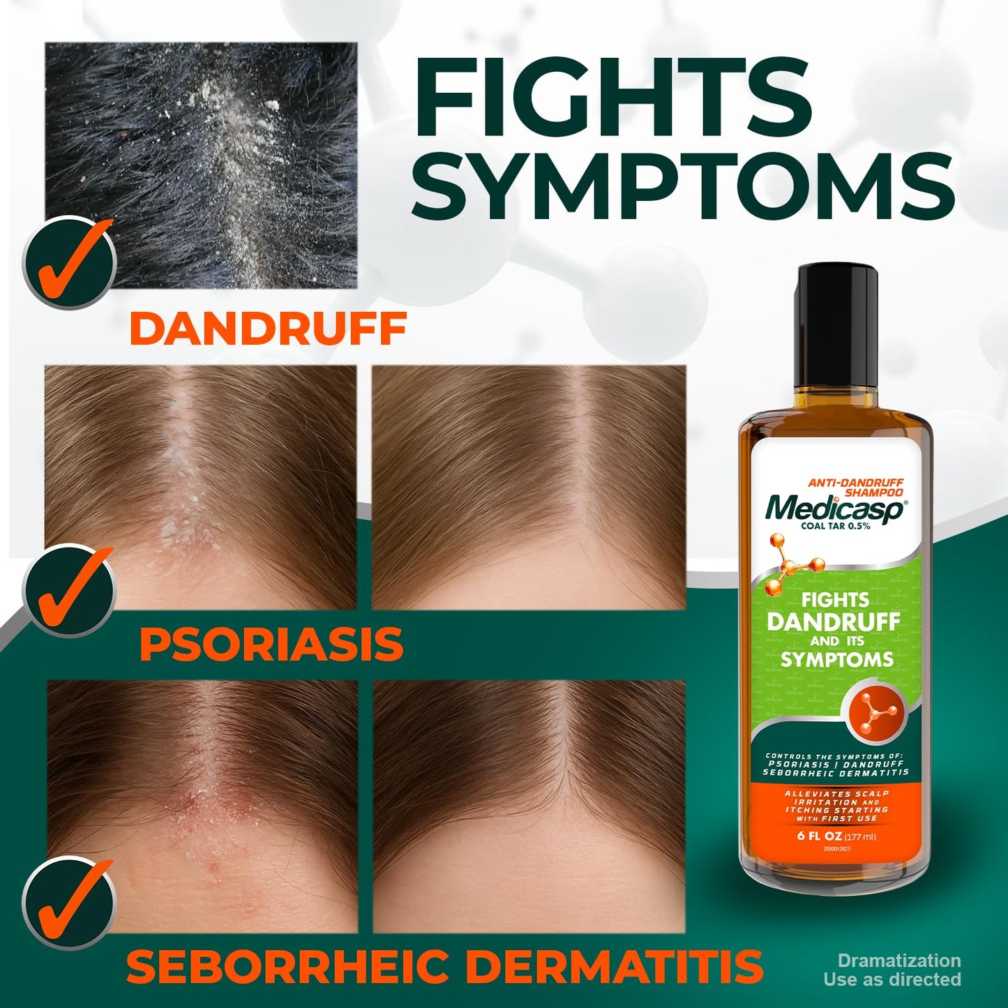 Medicasp Coal Tar Anti-Dandruff Shampoo - Starts Working from First Wash - 6 oz (3 Pack)
