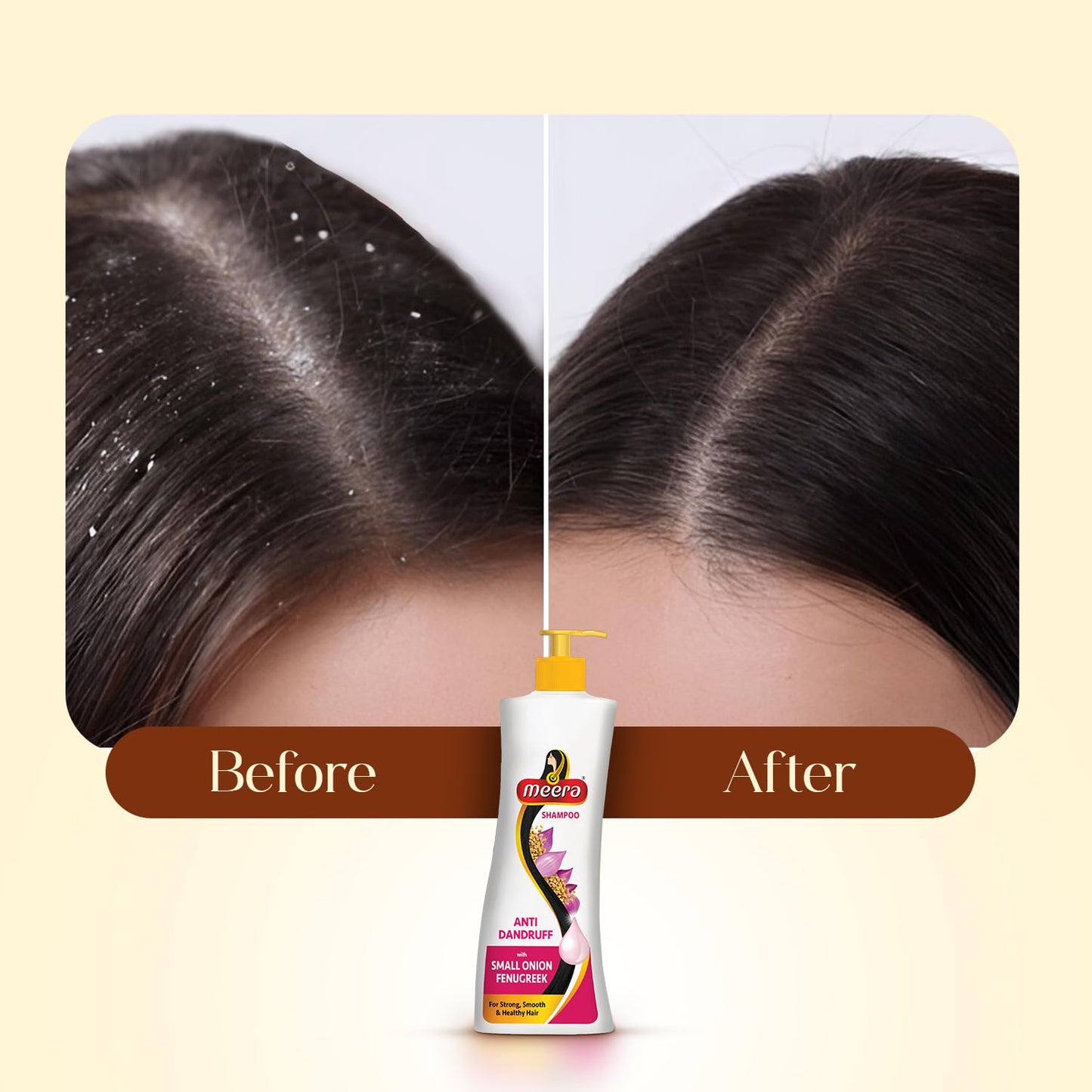 Meera Anti Dandruff Shampoo – White, 340ml | Gentle Cleansing for Scalp Comfort