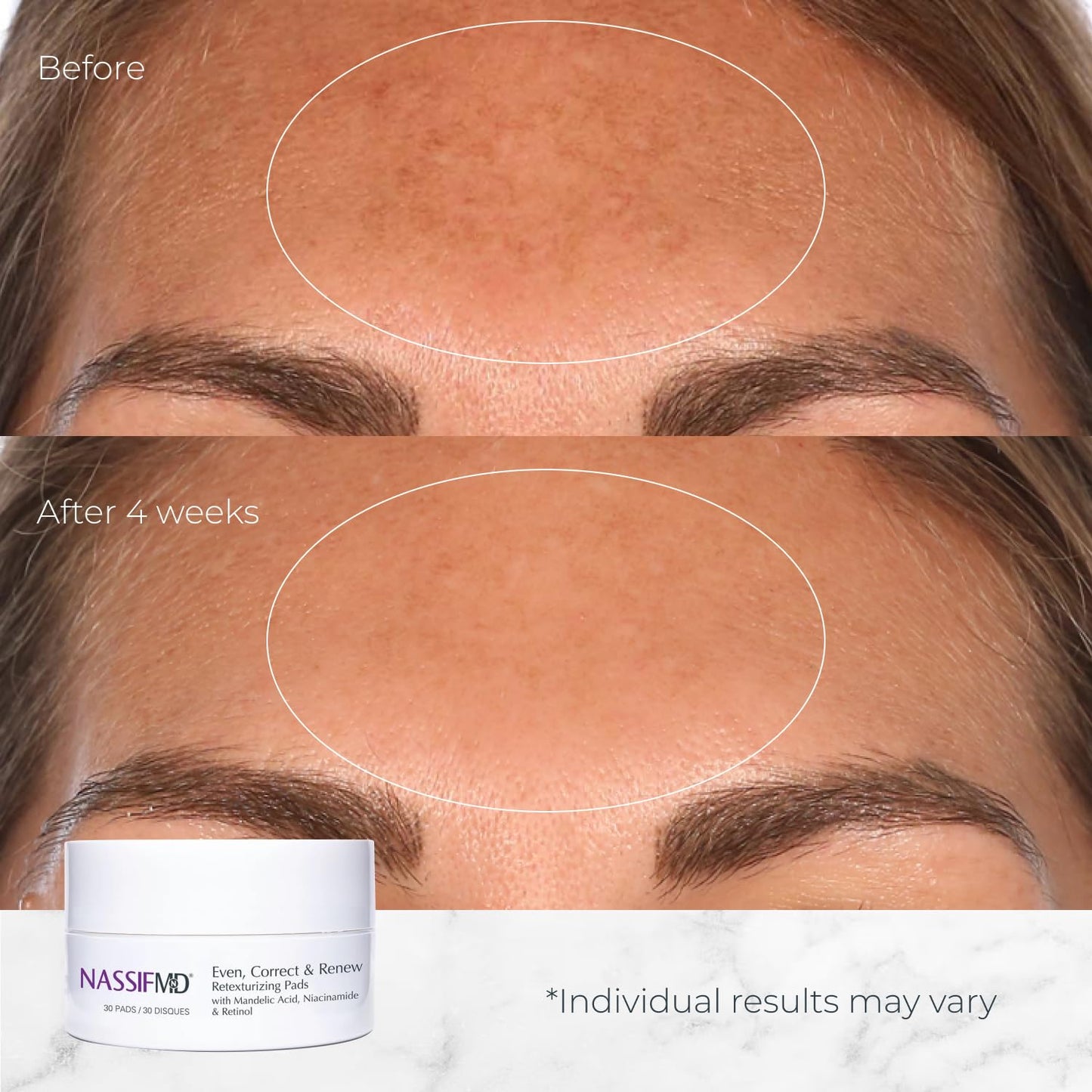 NassifMD Even, Correct & Renew Retexturizing Pads | Facial Peel for Texture & Tone