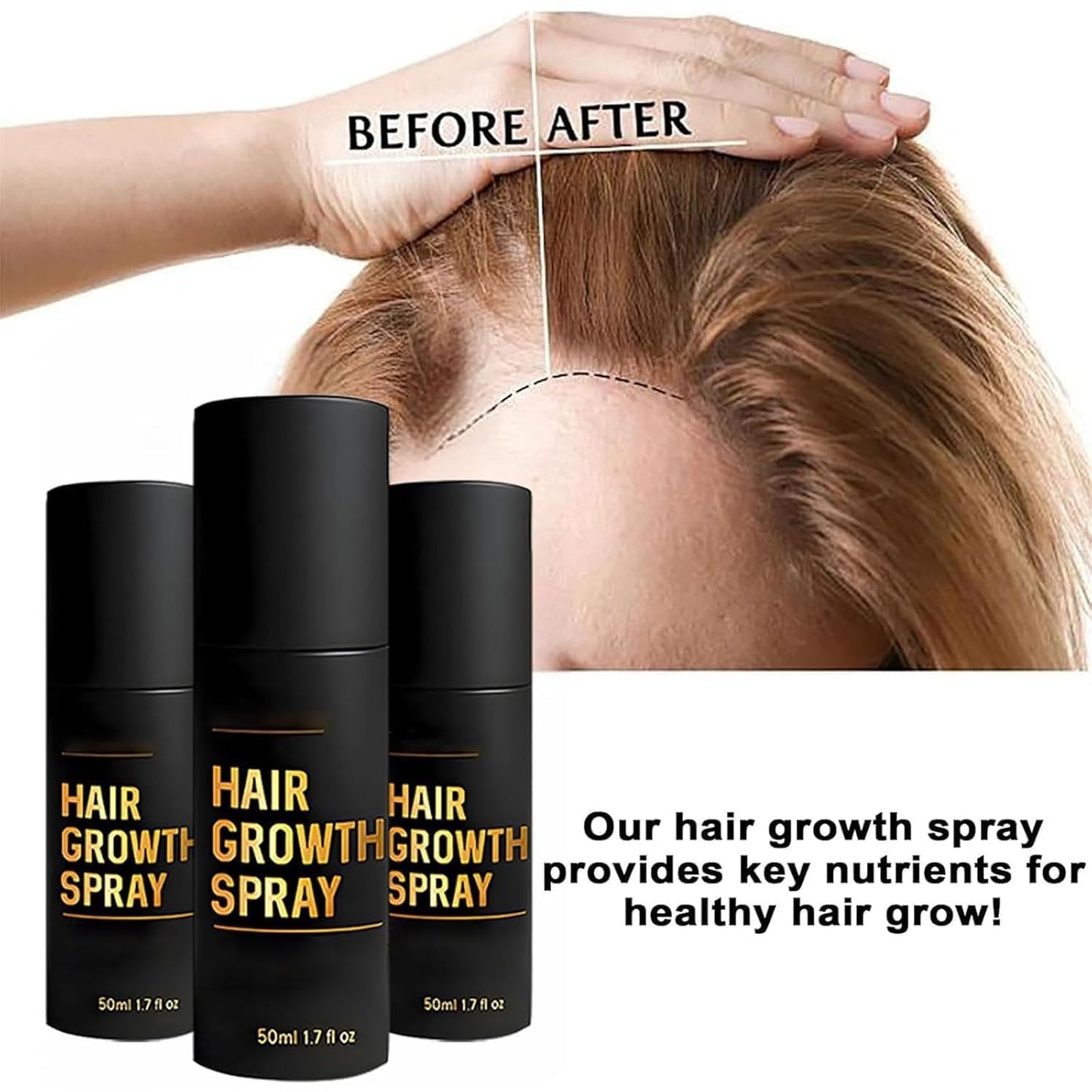 Nuckhuce 2-Piece Hair Growth Spray – Fuller, Thicker Hair for All Hair Types