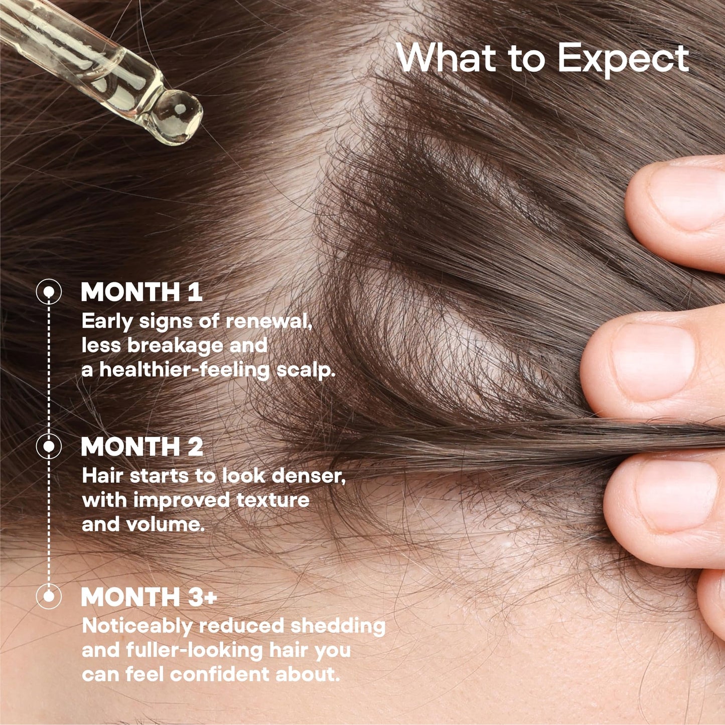 ONYX ProGro LactoPherma Hair Growth Serum – Oil-Free, 12-Ingredient Formula for Regrowth & Thickening