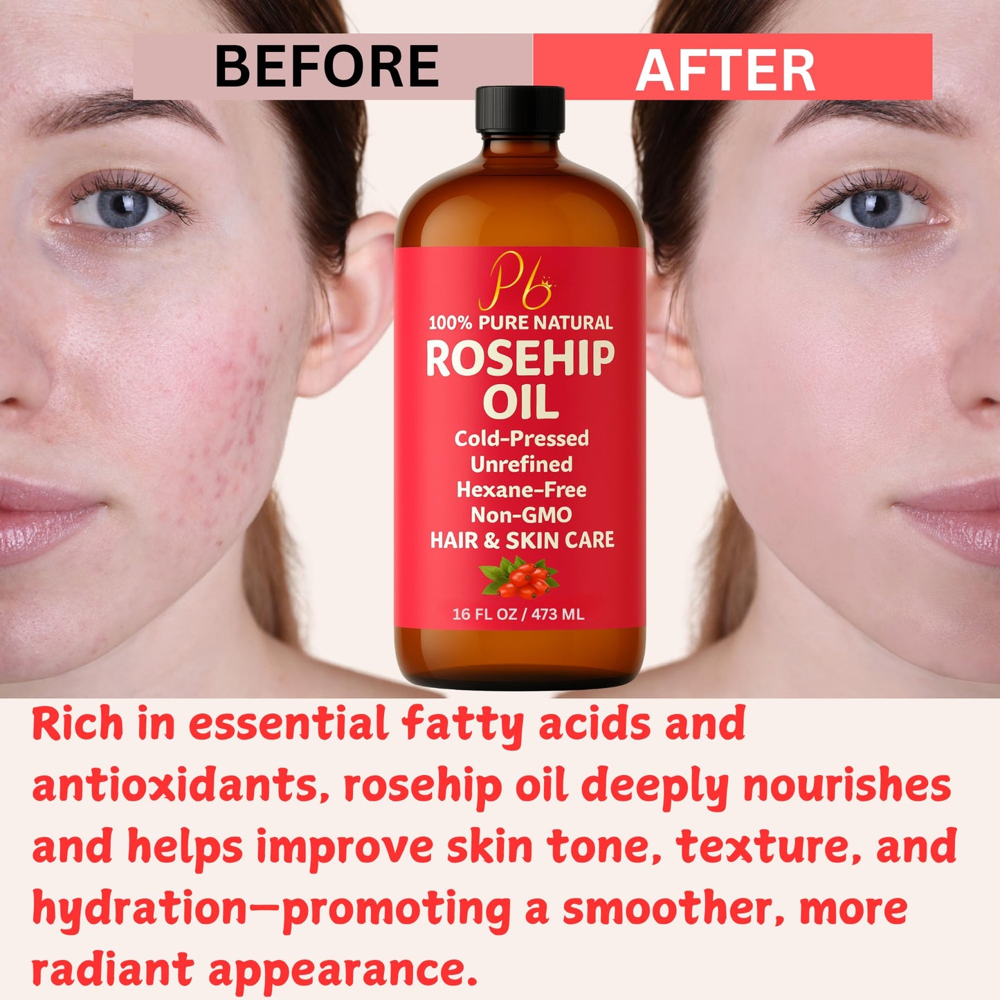 Pomberries Rosehip Seed Oil | Cold-Pressed & Unrefined, 16 oz Bottle for Face, Skin & Hair