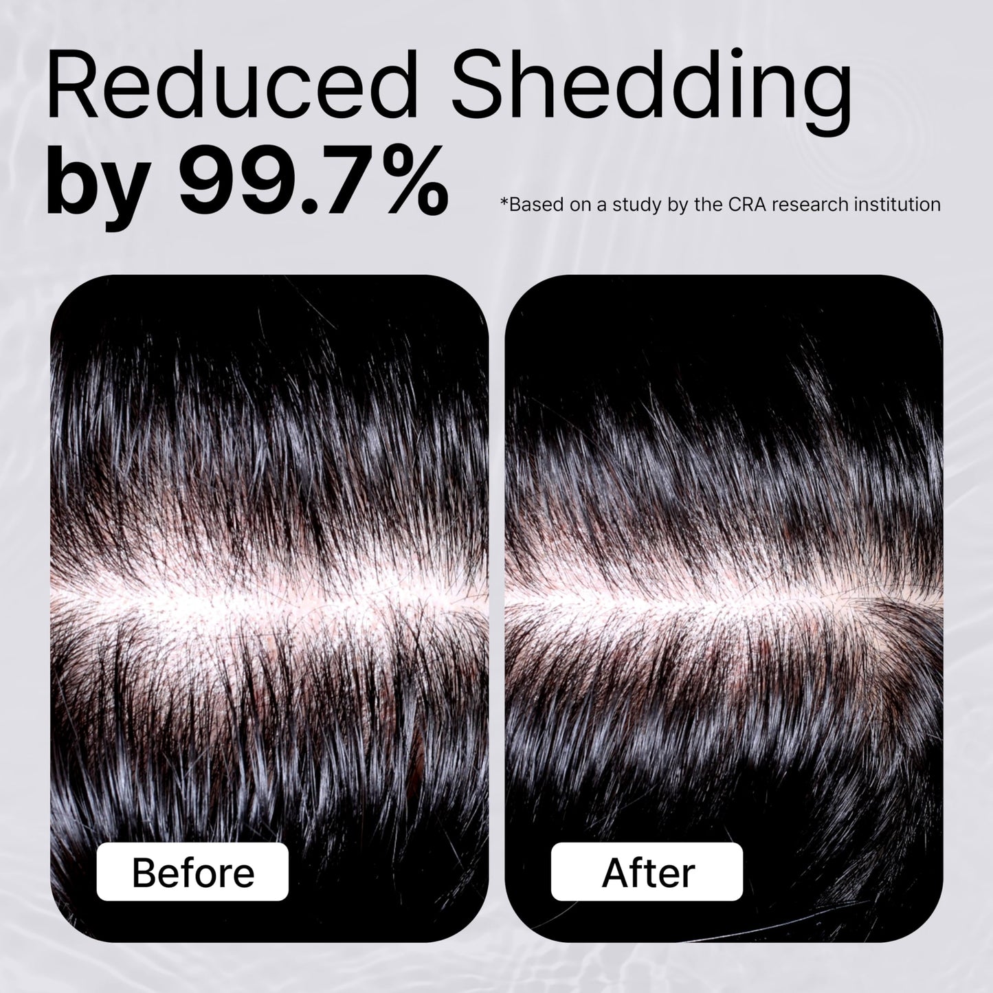 Refilled Booster Plus Moisture – Hair Growth Serum & Thickening Scalp Treatment with Built-In Massager
