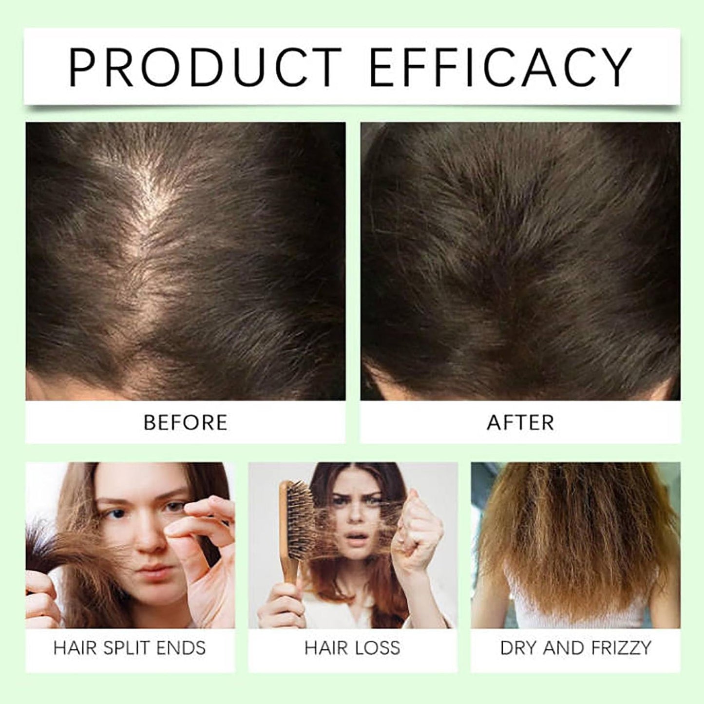 Remimpi Anti Hair Loss Shampoo – Plant-Powered Care for All Hair Types (2Pcs)