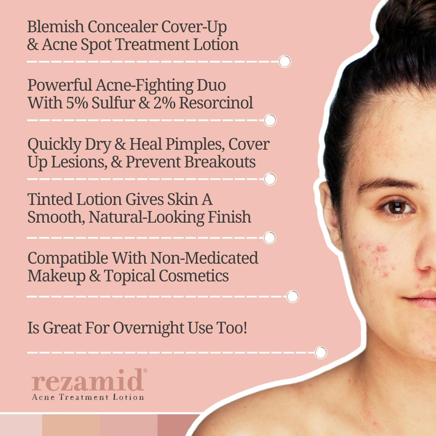Rezamid Acne Spot Treatment Lotion - 5% Sulfur & 2% Resorcinol, Oily Skin Concealer with Skin Tone Matching, 2oz