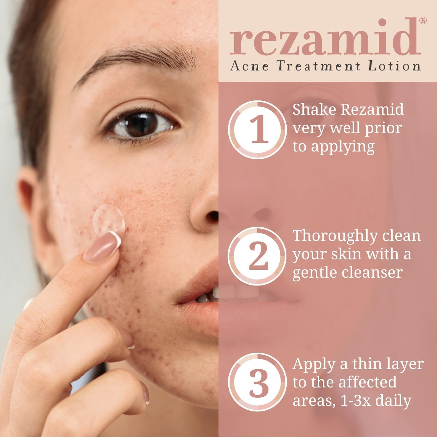 Rezamid Acne Spot Treatment Lotion - 5% Sulfur & 2% Resorcinol, Oily Skin Concealer with Skin Tone Matching, 2oz