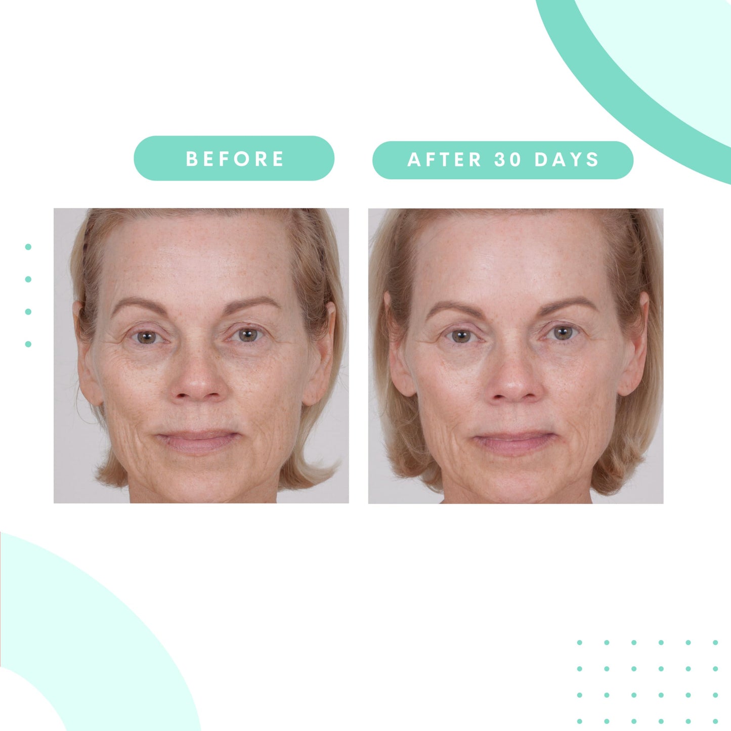 Serious Skincare Glycolic Gommage – Extreme Renewal Facial Mask, Micro Exfoliation