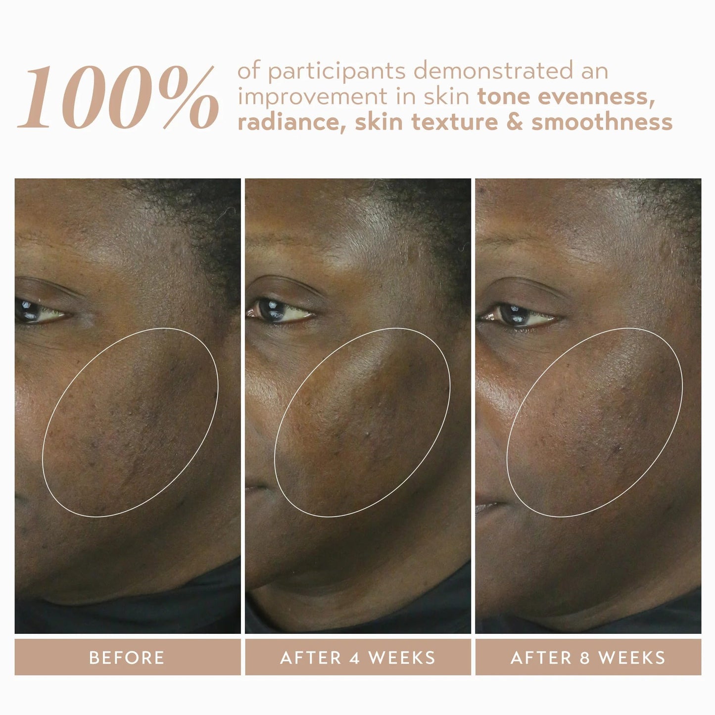 SHANI DARDEN Retinol Reform — 1% Encapsulated Retinol Serum for Face & Neck, Gentle Slow-Release, 0.3 oz
