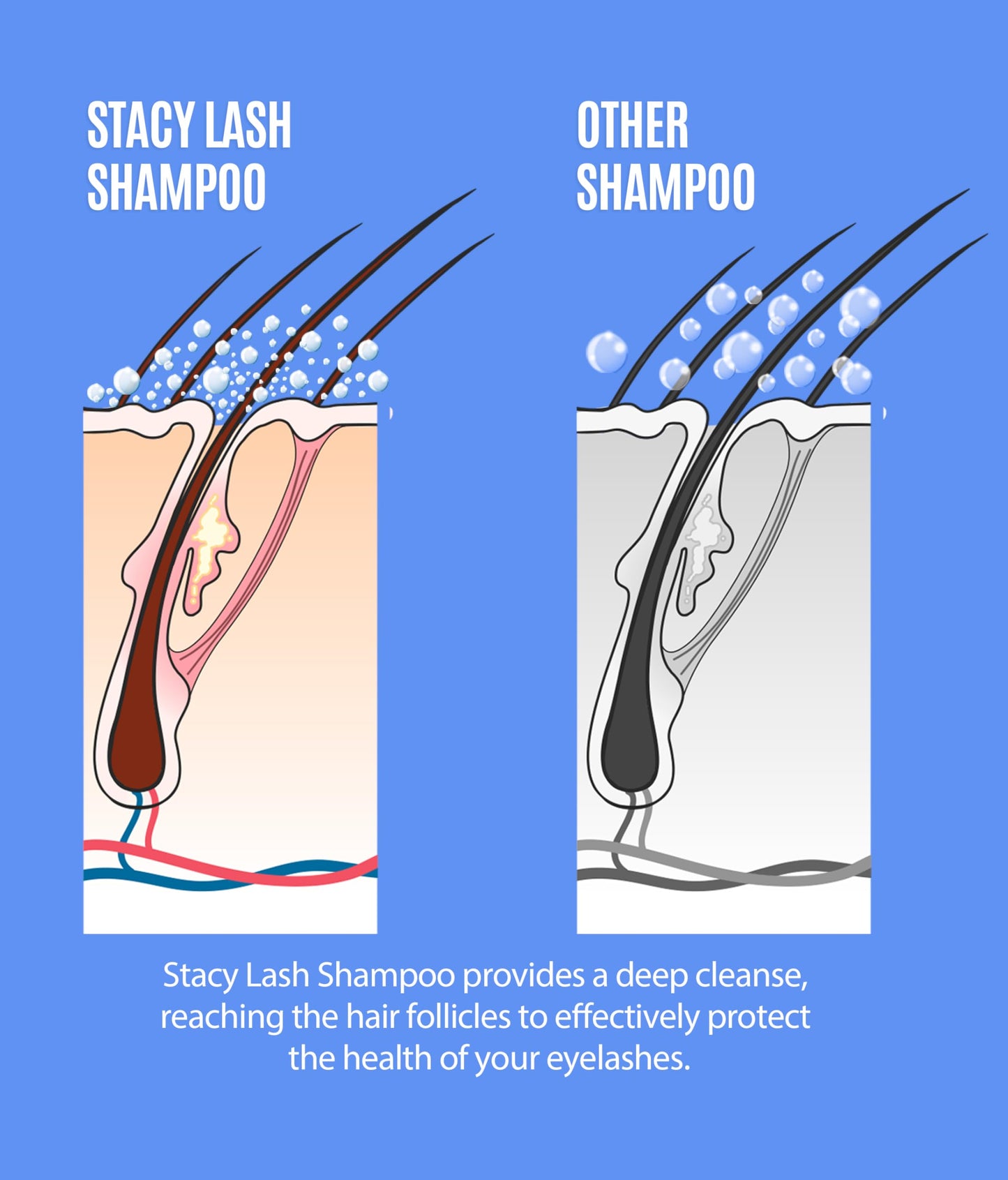 STACY LASH Shampoo & Lash Growth Serum Kit — 50ml Foaming Cleanser, Brush Bundle, 5ml Serum