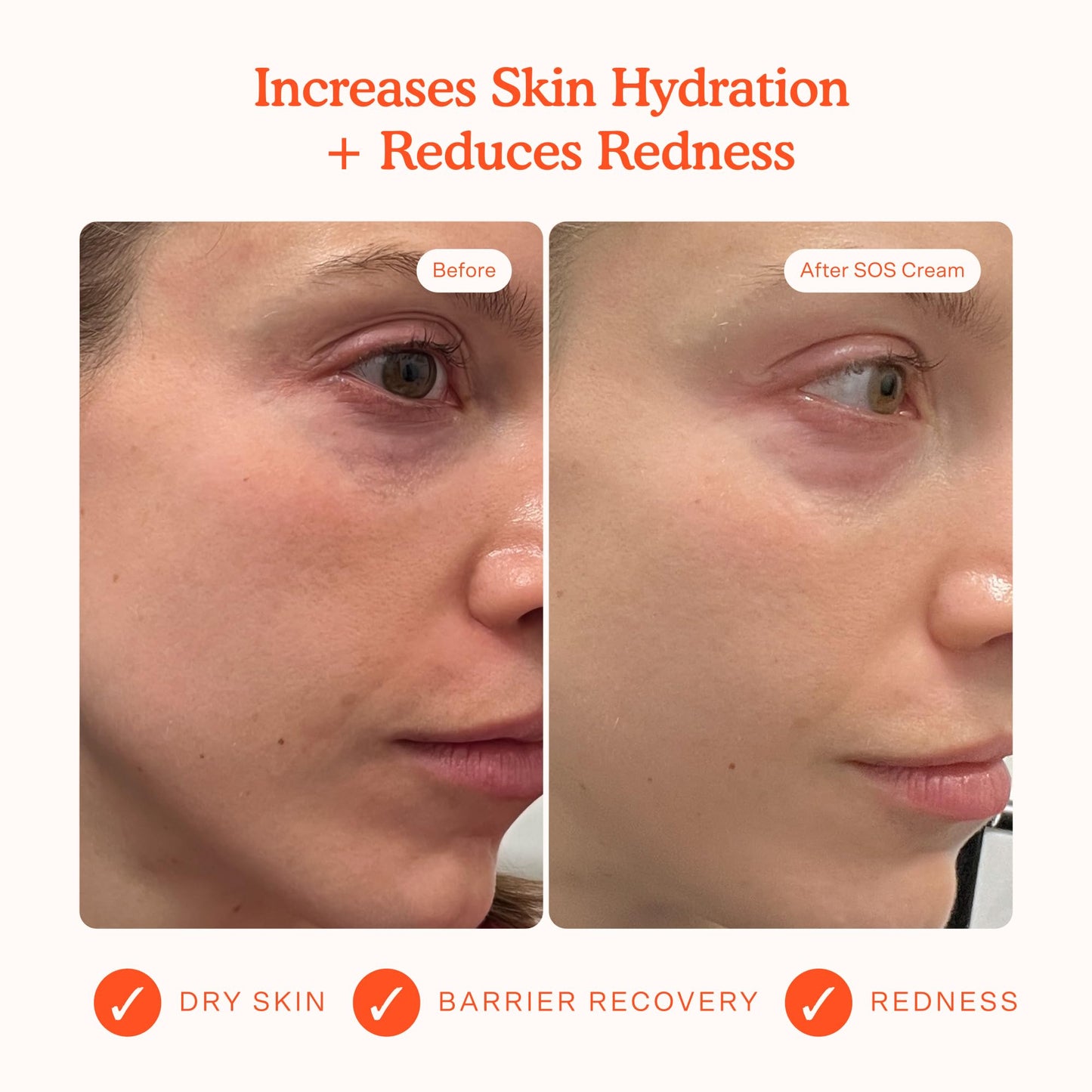 Tower 28 SOS Recovery Face Cream — Hydrating Moisturizer for Sensitive Skin with Hyaluronic Acid + Ceramides