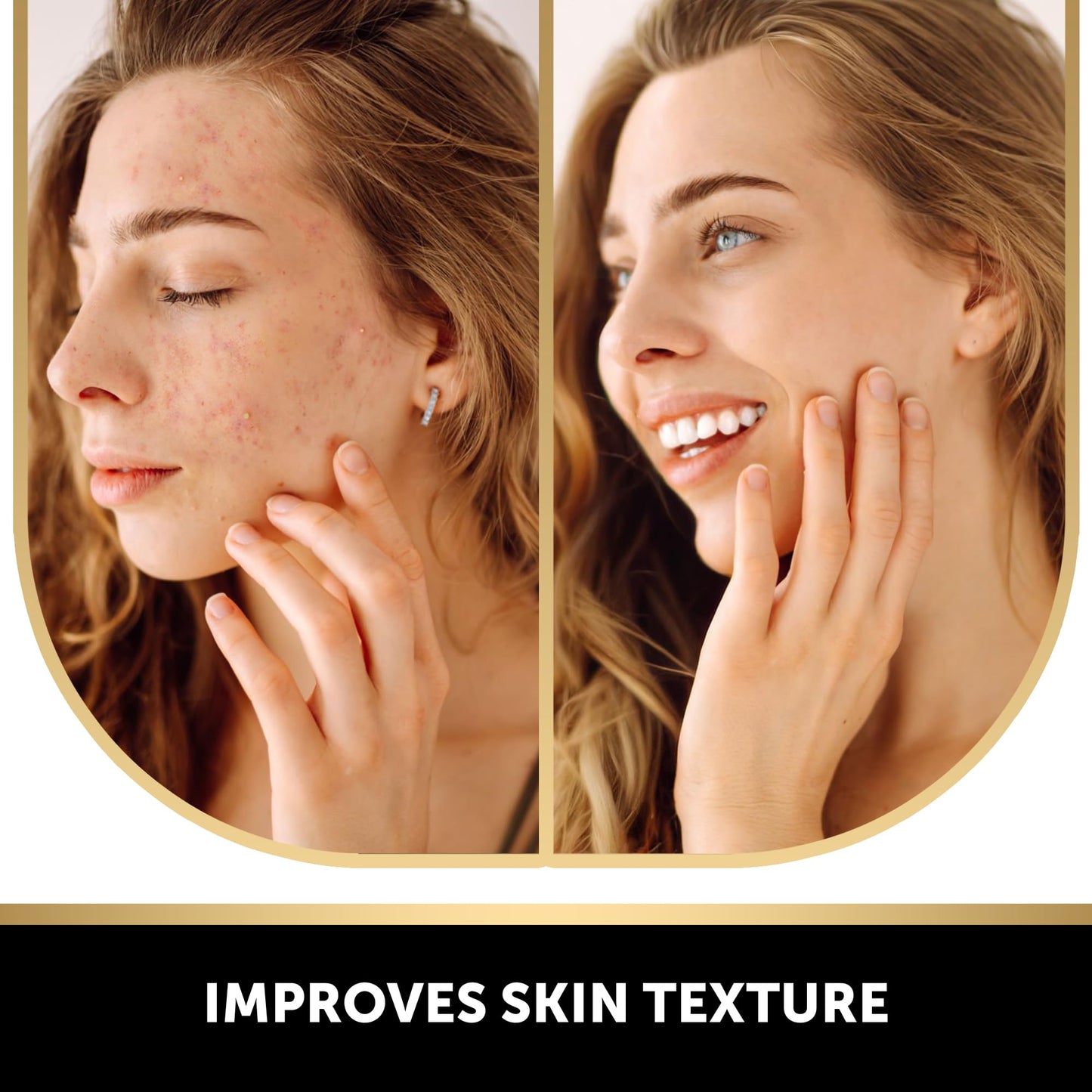 VALITIC Kojic Acid Vitamin C Retinol Soap Bars + Black Exfoliating Gloves — 4 Pack