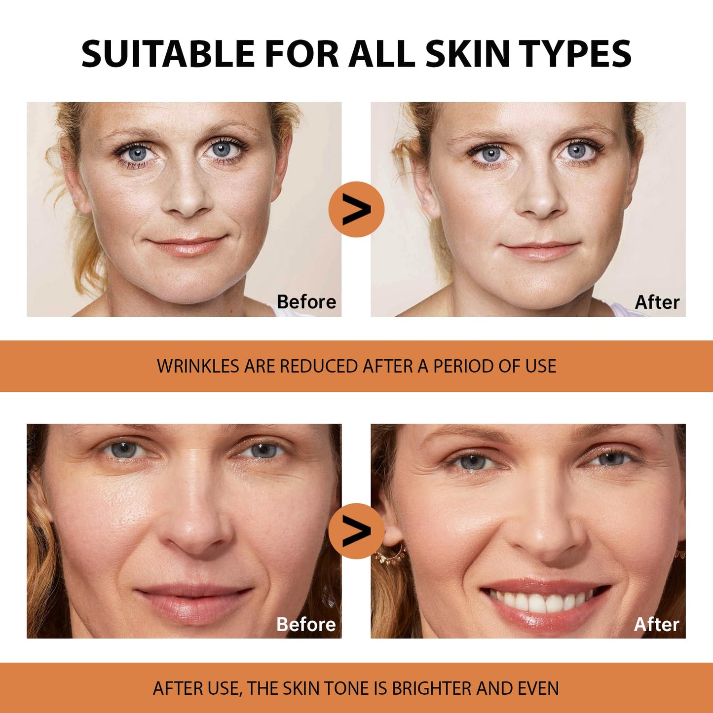 VGO 2 Pack Vitamin C Face Serum – Deep Hydration, Radiance & Even Tone