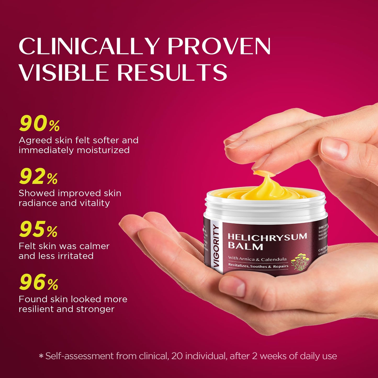 Vigority Helichrysum Balm – Soothes Fragile Skin with Arnica & Calendula, 3.4 oz